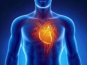 infarto miocardico