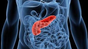 patologie del pancreas