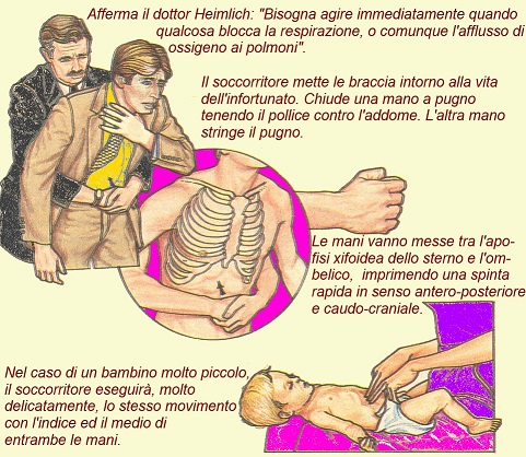 disostruzione