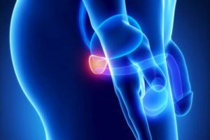 patologie della prostata