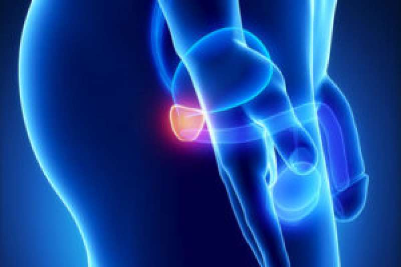 patologie della prostata