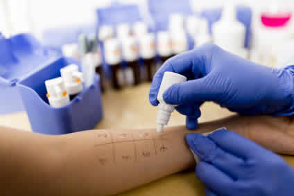 le malattie allergiche