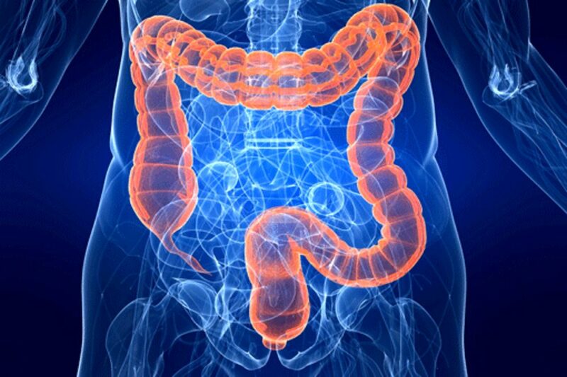 malatie del colon