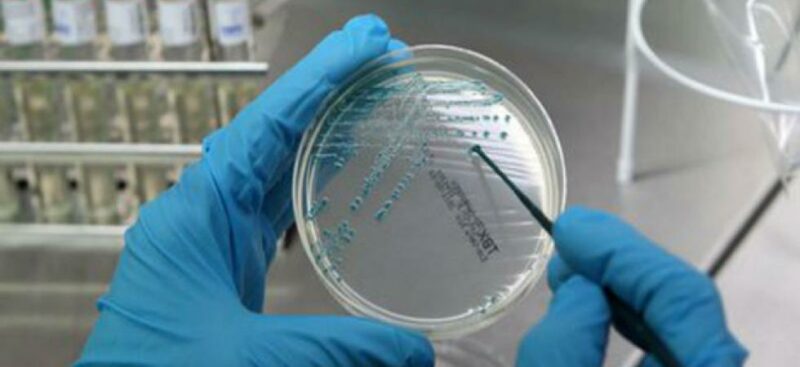 polmonite da legionella