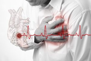 aritmie cardiache