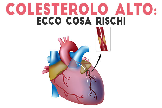 il colesterolo il colesterolo