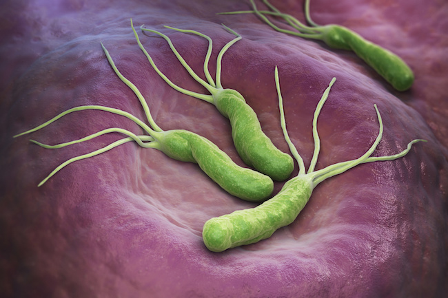 Helicobacter pylori probiotici
