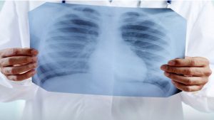 gli esami radiologici