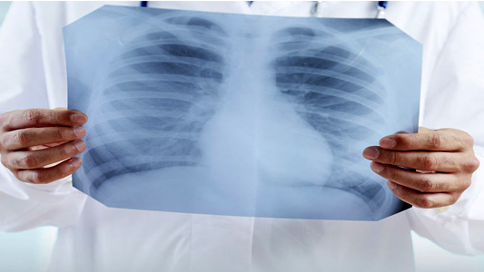 gli esami radiologici gli esami radiologici
