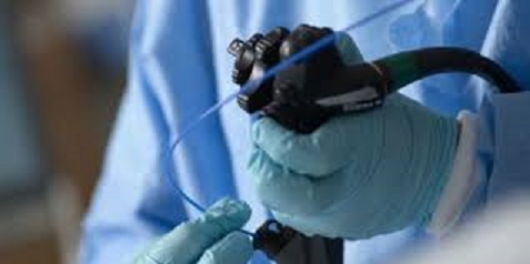 endoscopio.jpg
