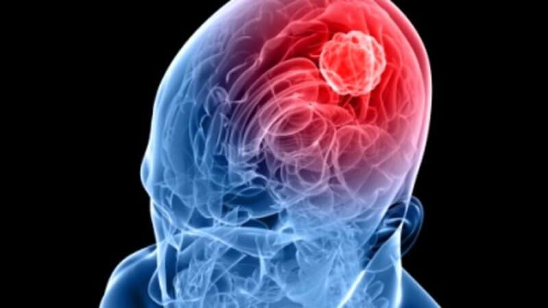 meningite