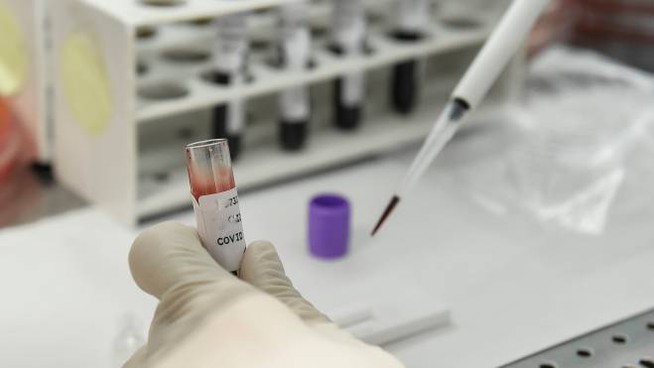 test coronavirus