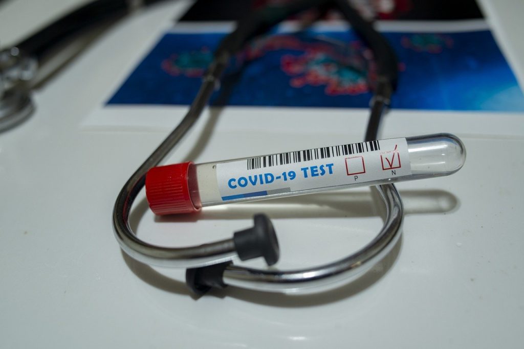 covid 19 coronavirus laboratorio infermiere test postitivo 1 covid 19 coronavirus laboratorio infermiere test postitivo 1