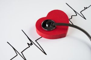 le aritmie cardiache