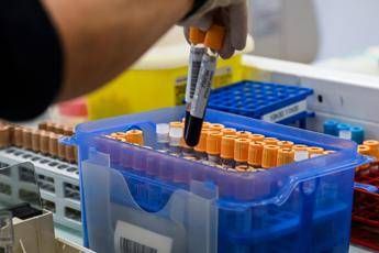 Fegato un test per scoprire il rischio di gravi malattie entro 10 anni lo studio