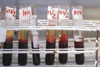 Salute da Hiv a infezioni sessuali lotta a sommerso al via settimana europea test