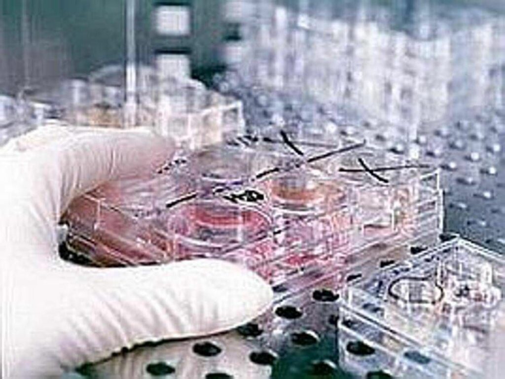 Fecondazione non solo endometriosi il nuovo protocllo che combatte ladenomiosi