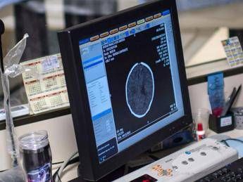 Salute Padovani Sin Longevita aumenta rischio Alzheimer agire su prevenzione Salute Padovani Sin Longevita aumenta rischio Alzheimer agire su prevenzione