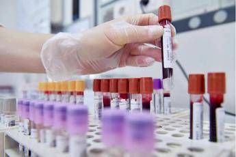 Cancro al seno oncologi Bene test genomici nei nuovi Lea fare presto