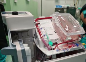 A Bergamo trapiantato un cuore ancora battente grazie alla nuova “scatola sterile”
