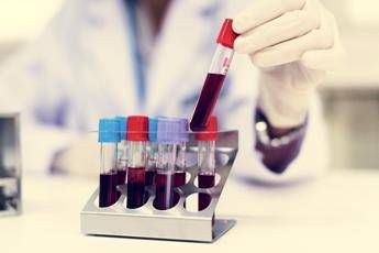 Nuovo tipo di diabete giovanile scoperto in Africa la conferma che cambia la storia in un maxi studio Nuovo tipo di diabete giovanile scoperto in Africa la conferma che cambia la storia in un maxi studio