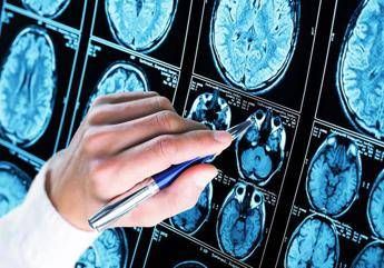 Farmaci ok Ema a donanemab neurologi Svolta in lotta allAlzheimer Farmaci ok Ema a donanemab neurologi Svolta in lotta allAlzheimer