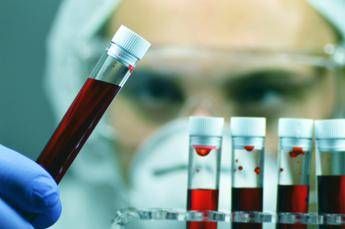 Tumori Ue approva terapia per adulti con leucemia linfatica cronica refrattaria