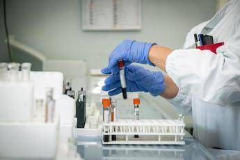 Mielofibrosi ematologo Con uso precoce momelotinib maggiore sopravvivenza