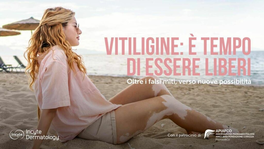 Salute Giornata vitiligine al via campagna Oltre falsi miti verso nuove possibilita