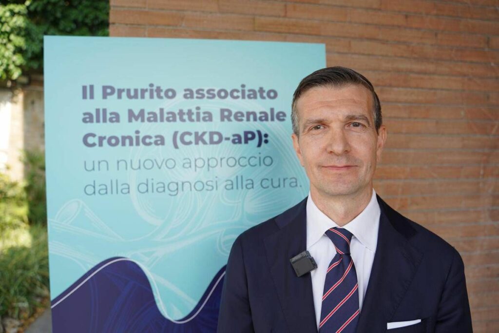 Cucchiaro Csl Vifor Italia Orgogliosi per terapia prurito da malattia renale cronica
