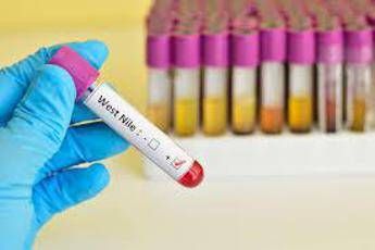 West Nile medici ambiente 250mila morti lanno per malattie da clima entro 2050 West Nile medici ambiente 250mila morti lanno per malattie da clima entro 2050