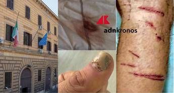 Picchiato e sequestrato per due giorni da altri detenuti a Regina Coeli la denuncia choc Picchiato e sequestrato per due giorni da altri detenuti a Regina Coeli la denuncia choc