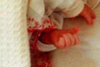 Torino neonata salvata da rara malformazione al fegato con colla istantanea