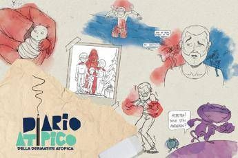 Dermatite atopica oltre 13 mln di persone hanno visto il corto Diario atipico Dermatite atopica oltre 13 mln di persone hanno visto il corto Diario atipico