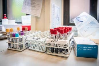 Medicina di laboratorio un semplice esame per scoprire in anticipo le patologie Medicina di laboratorio un semplice esame per scoprire in anticipo le patologie