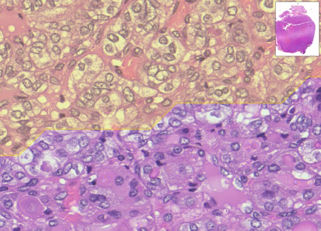 Immagini di campione analizzato con il sistema MiThyCA