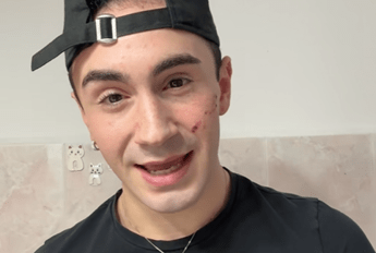 Genova 19enne denuncia aggressione omofoba Sfregiato al viso con coltellino