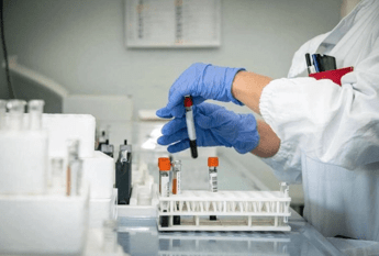 Alzheimer test del sangue possono prevedere linizio dei sintomi