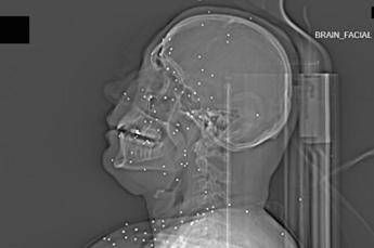 Linchiesta horror sulle violenze iraniane Manifestanti uccisi e colpiti nelle parti vitali