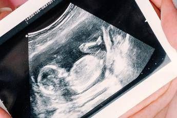 Gravidanza arrivano le nuove linee guida dellIss ecco quando fare e quando non fare lecografia e altri esami Gravidanza arrivano le nuove linee guida dellIss ecco quando fare e quando non fare lecografia e altri esami