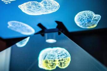 Ictus ecco come lemisfero sano del cervello influenza la ripresa la ricerca rivoluzionaria