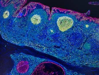 Irccs Pascale Napoli mappa Gps delle cellule rivoluziona limmunoterapia Irccs Pascale Napoli mappa Gps delle cellule rivoluziona limmunoterapia