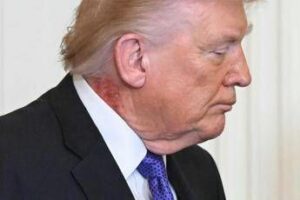 Trump e il collo arrossato la foto riaccende i dubbi sulla salute del presidente Trump e il collo arrossato la foto riaccende i dubbi sulla salute del presidente