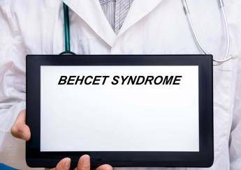 Giornata sindrome Behcet esperto Oggi possiamo prevenire cecita Giornata sindrome Behcet esperto Oggi possiamo prevenire cecita