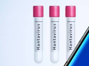 Hantavirus non puo causare pandemia ma epidemie gravi si lo studio su focolaio Mv Hondius