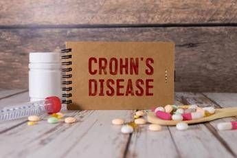 Malattia Crohn con fistole nuovi dati su terapia monoclonale