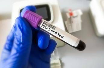 Tumore gastroesofageo Her2 risultati positivi per tislelizumab con zanidatamab e chemio