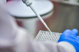 Idrosadenite suppurativa alla Camera focus su Lea Piano cronicita e innovazione terapeutica Idrosadenite suppurativa alla Camera focus su Lea Piano cronicita e innovazione terapeutica